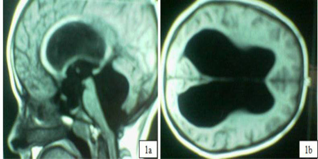 fig_1_apla_converted.jpg